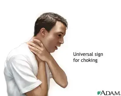 Universal Sign For Choking